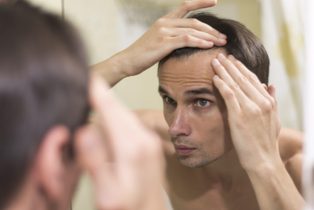 Caida de pelo